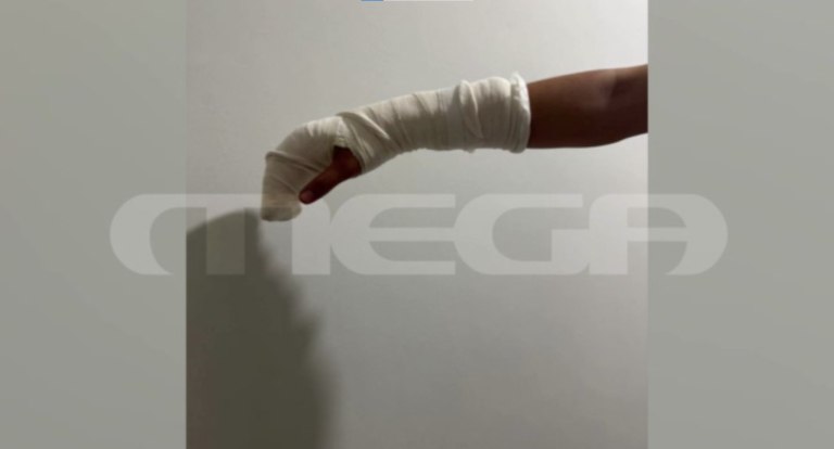 Κυψέλη: Του διέλυσαν τον τένοντα  Σοκάρουν οι περιγραφές της μητέρας του 17χρονου που ξυλοκοπήθηκε μέσα στο σχολείο