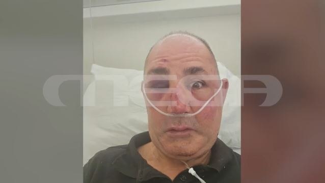 Ρόδος: Σοκάρουν οι εικόνες από την άγρια επίθεση σε κοσμηματοπώλη  Έλεγα ότι θα πεθάνω