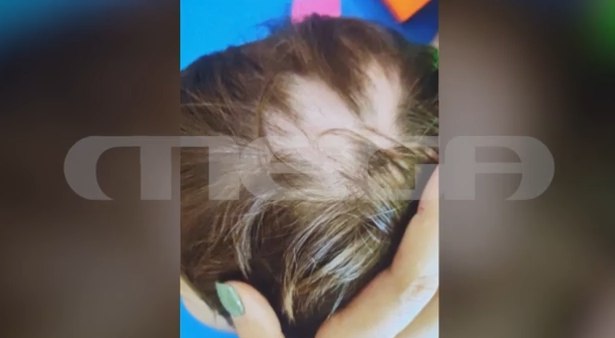 Αυλώνας: Το παιδάκι ήταν μια χαρά και ξαφνικά γύρισε στην κατάσταση αυτή και με χτυπημένα χείλια, λέει η βρεφονηπιοκόμος