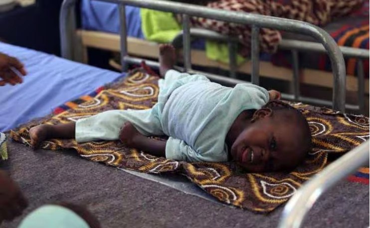 Η μηνιγγίτιδα σκοτώνει πάνω από 250.000 ανθρώπους σε όλον τον κόσμο κάθε χρόνο  Το ένα τρίτο είναι παιδιά