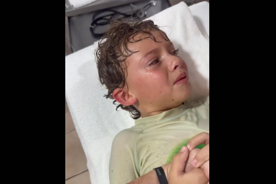 Γιατρός βγάζει καβούρι ζωντανό από το αυτί μικρού αγοριού στο Μεξικό (video)